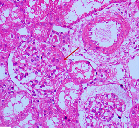 December%202018%20case%201