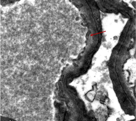 December%202018%20case%202