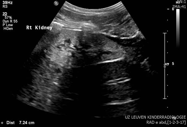 July%202017%20image2%20